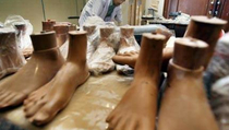 Mengenali Penyakit Deformitas Jari Kaki