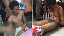 Kondisi Tersangka Bom Medan Masih Sangat Lemah