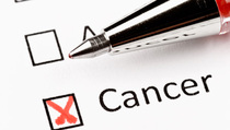 Imunoterapi Sel Tingkatkan Harapan Hidup Pasien Kanker