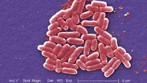 10 Juta Orang Terancam Tewas akibat Resistensi Antibiotik