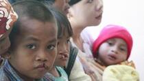 Ibu Merokok Berpotensi Melahirkan Anak dengan Bibir Sumbing