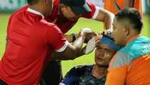 Dapat 8 Jahitan, Bek Arema Siap Turun di Semifinal Kedua