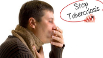 Pembahasan Tuberkulosis di Forum G-20, Langkah Konkret Eleminasi TB