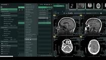 RS PON Terapkan Teknologi Kecerdasan Buatan di Intalasi Radiologi