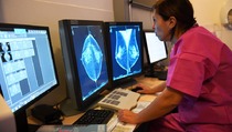 Ladies, Kenali Gejala Kanker Payudara yang Jarang Disadari