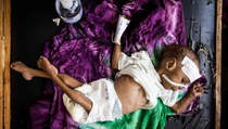 Kekeringan, 7,2 Juta Warga Etiopia Butuh Bantuan Pangan