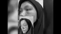 Terjadi Lagi, Mahasiswi Dipukul Senior hingga Luka Lebam