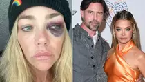 Denise Richards, Pemeran Gadis James Bond Jadi Korban KDRT
