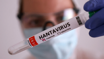 WHO Ingatkan Ancaman Hantavirus, Kasus Baru Bisa Bermunculan