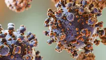 Kemenkes Prancis: 1 Orang Positif Hantavirus