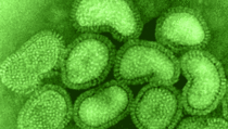 Pasien R di RSUD Tangerang, Meninggal Akibat Virus H1N1