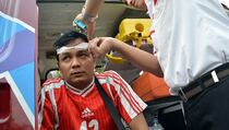 Jelang Final Piala Presiden, 1 Suporter Terluka di Bagian Kepala