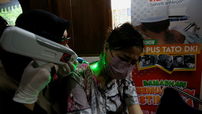 Warga mengikuti proses hapus tato gratis di kantor Dewan Pimpinan Pusat Forum Ulama Habaib, Jakarta Selatan, Selasa, 19 April 2022.