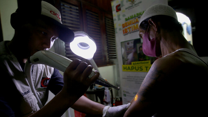 Warga mengikuti proses hapus tato gratis di kantor Dewan Pimpinan Pusat Forum Ulama Habaib, Jakarta Selatan, Selasa, 19 April 2022.