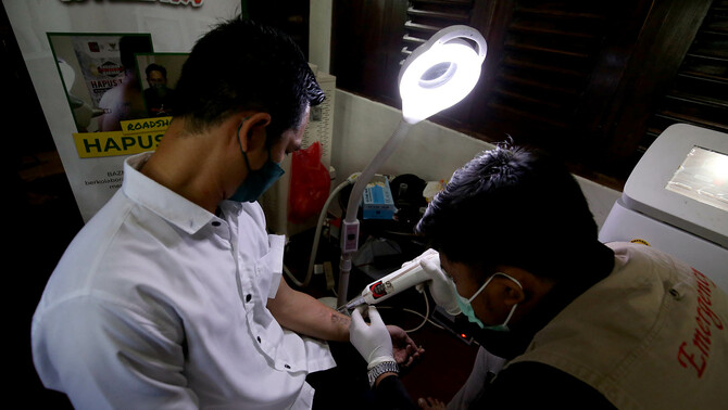 Warga mengikuti proses hapus tato gratis di kantor Dewan Pimpinan Pusat Forum Ulama Habaib, Jakarta Selatan, Selasa, 19 April 2022.