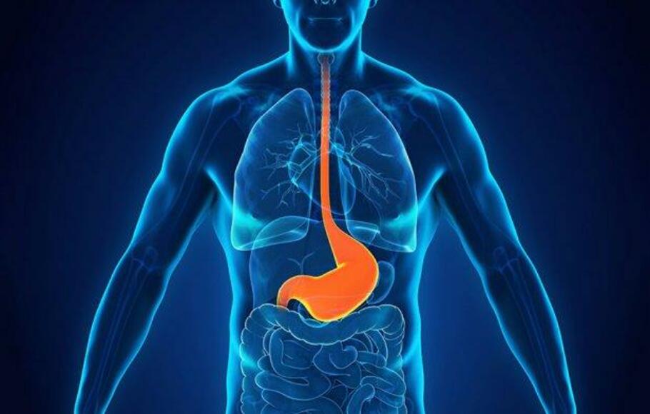 Ilustrasi Gastroesophageal Reflux Disease atau GERD