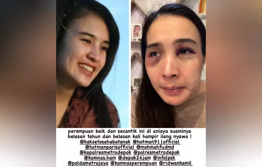 Seorang warganet, bernama Sahara Hanum di akun Twitternya @saharahanum mengungkapkan kejadian yang menimpa kakak kandungnya bernama Putri Balqis yang menjadi korban KDRT oleh suaminya, Rabu, 24 Mei 2023.