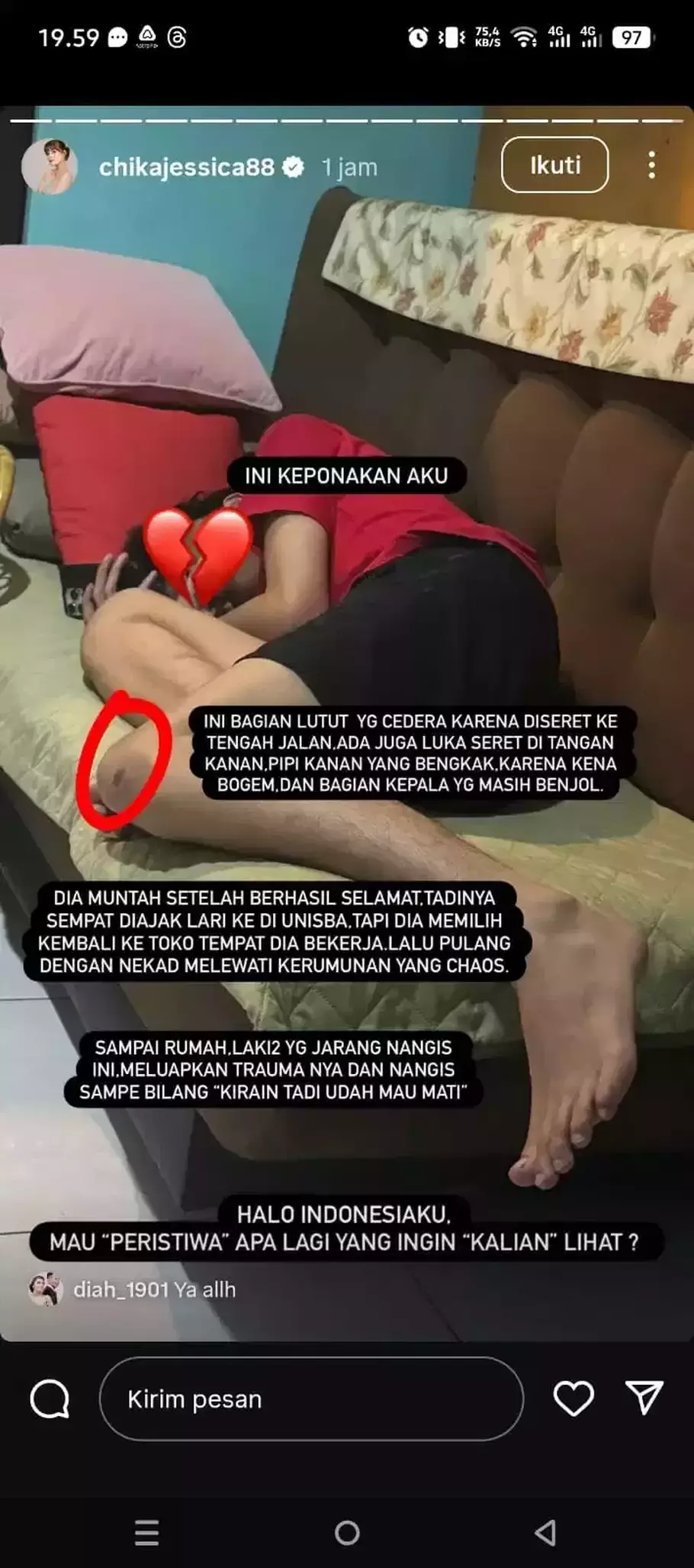 Chika Jessika mengabarkan kondisi keponakannya yang diduga menjadi salah sasaran kepolisian. - (Beritasatu.com/Instagram)