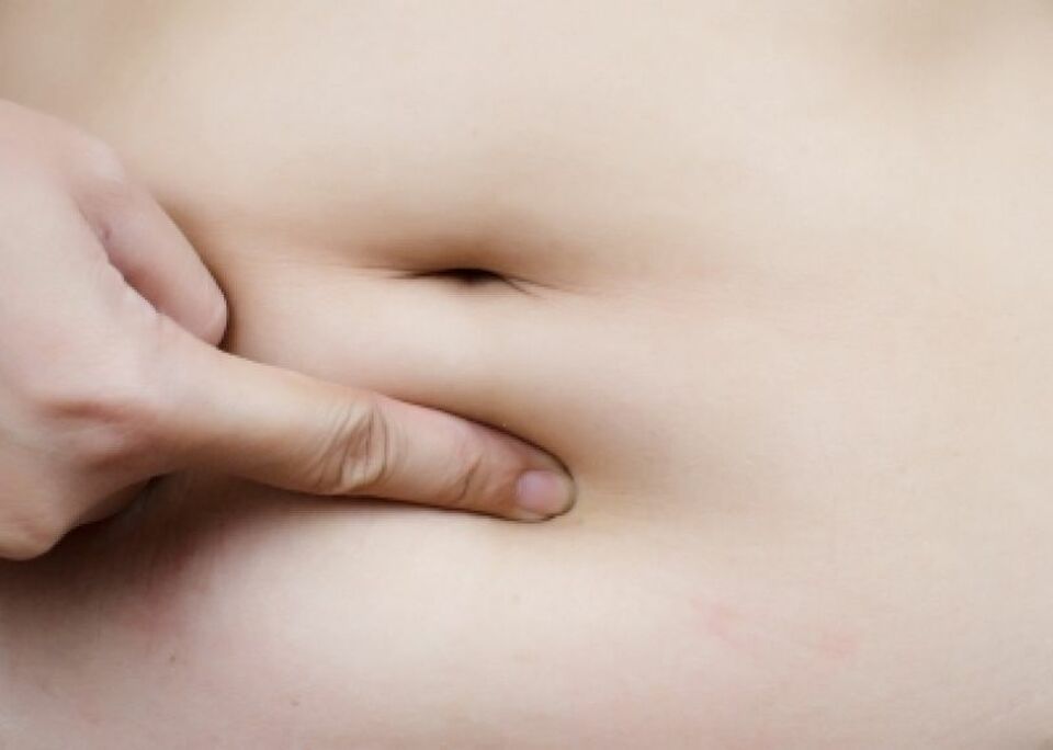 Ilustrasi lemak di sekitar perut.