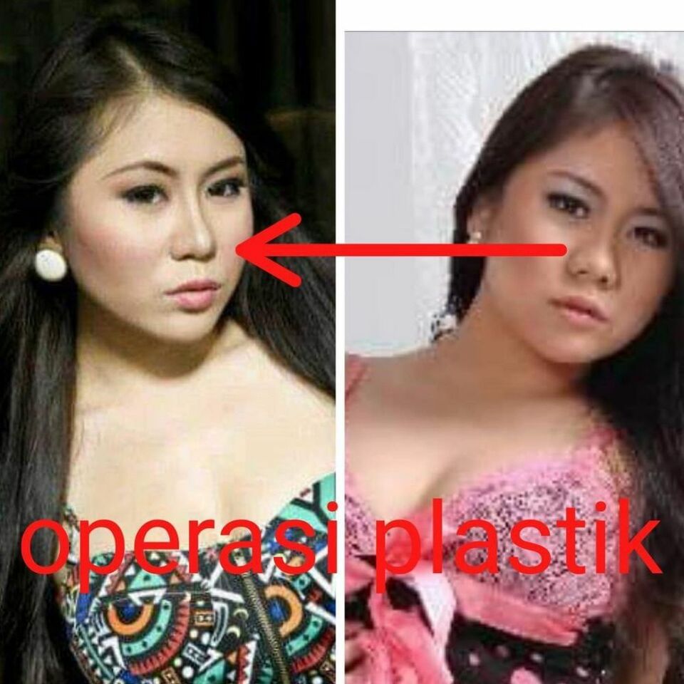 Foto unggahan di media sosial yang menuduh Ayu Thalia melakukan operasi plastik.