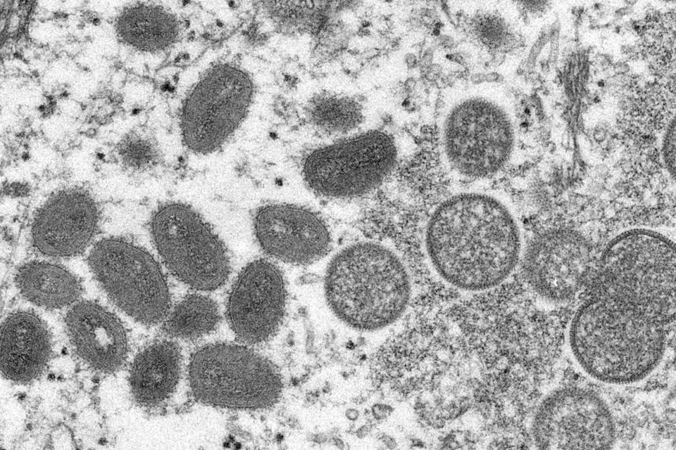 WHO menyatakan kemungkinan mutasi cenderung lebih rendah pada virus cacar monyet.