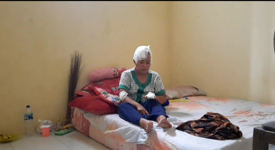 Nani Hermawan, korban penganiayaan dengan kapak oleh suaminya sendiri. 