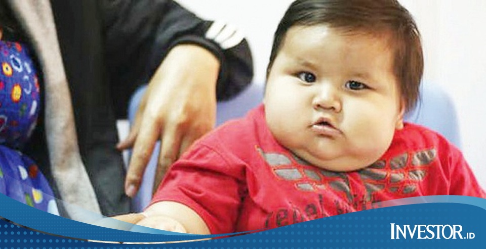 Kenali Gejala dan Cara Menghindari Obesitas pada Anak