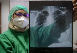 Gov’t to Earmark Up to Rp 200.8 Trillion for Healthcare Next Year