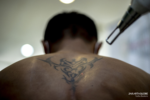 Repent and Clean: Former Hoodlums Remove Tattoos as Penitence