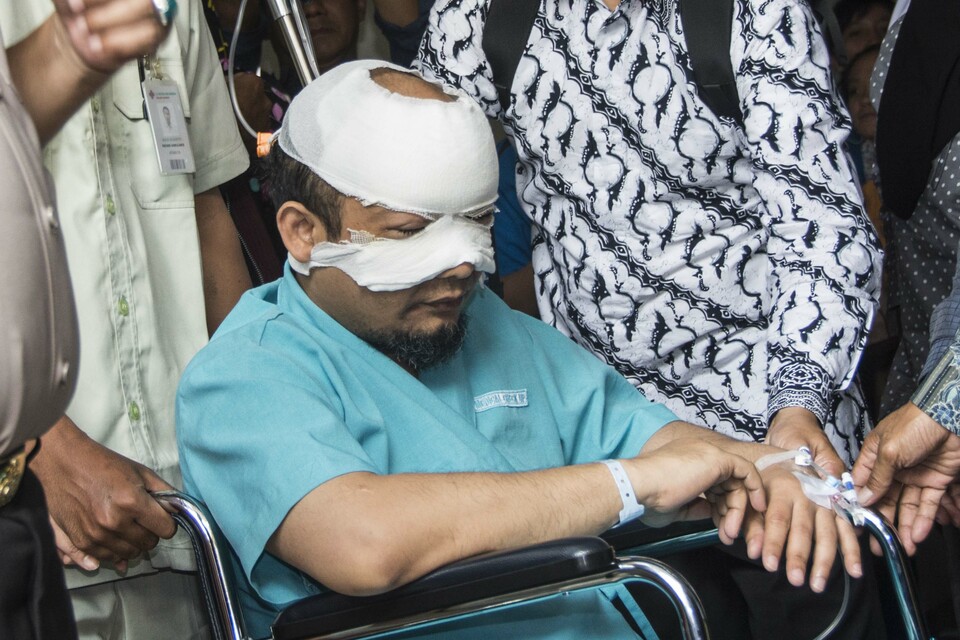 The National Police have called on the public to remain patient as they work to resolve their investigation of the April 11 acid attack on Novel Baswedan, a Corruption Eradication Commission, or KPK, senior investigator.(Antara Photo/Aprillio Akbar)