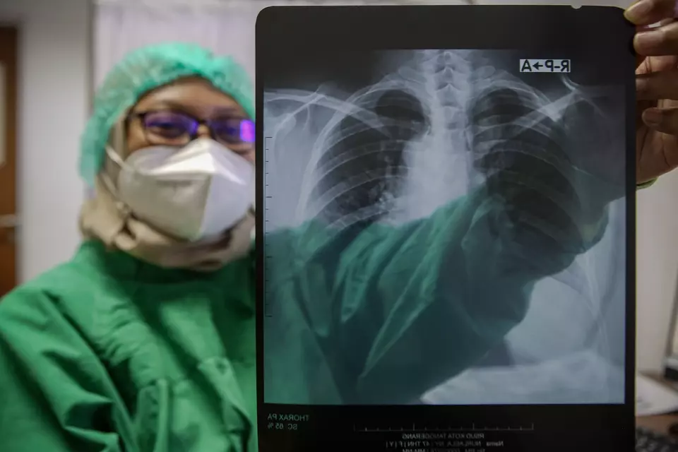 A healthcare worker shows a chest radiograph of a patient at a hospital in Tangerang on March 21, 2023. (Antara Photo/Fauzan)
